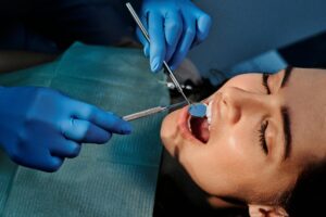 santé des dents et sucre